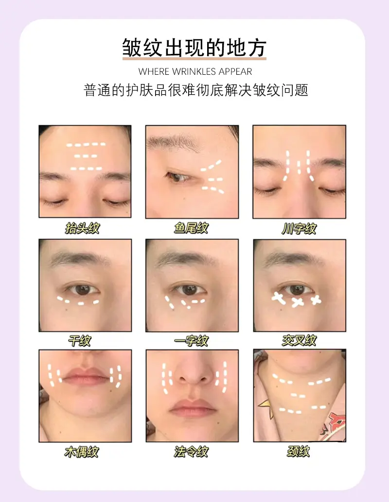 Silicone Anti-Wrinkle Face Patch for Tightening & Lifting — feature 8