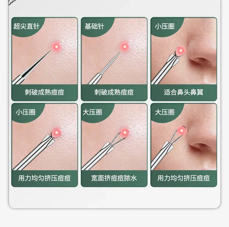 Super Sharp No.5 Cell Tweezers Blackhead Pox Acne Clamp — feature 9