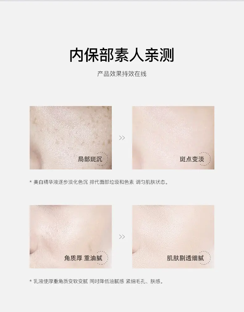 377 Niacinamide Whitening Toner & Lotion Set — feature 18