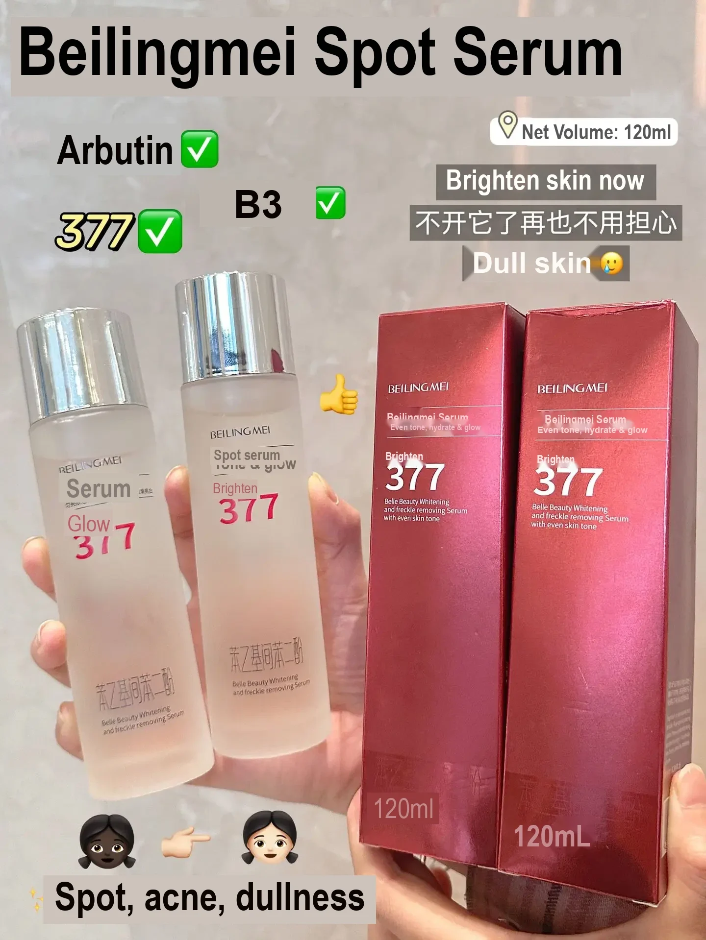 Two 377 essence bottles and two red boxes held in hands.