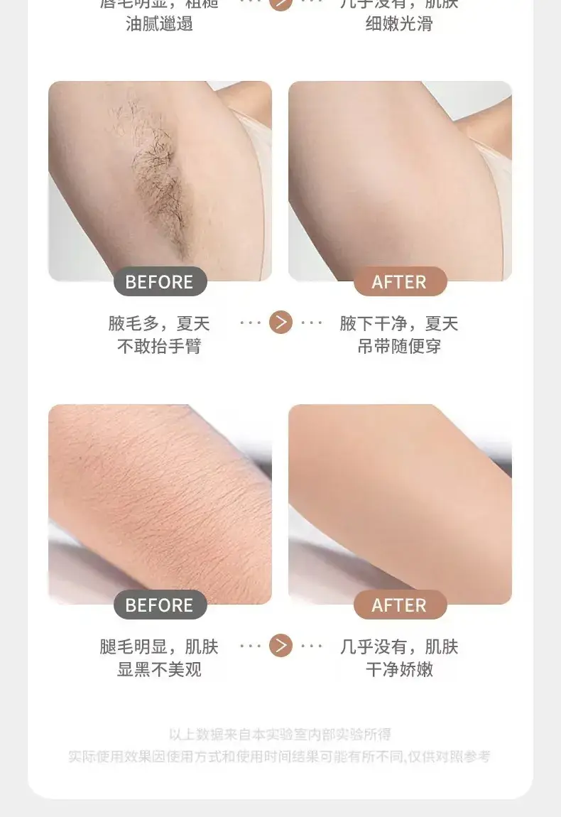 LED Electric Shaver for All Body Hair Removal — feature 6