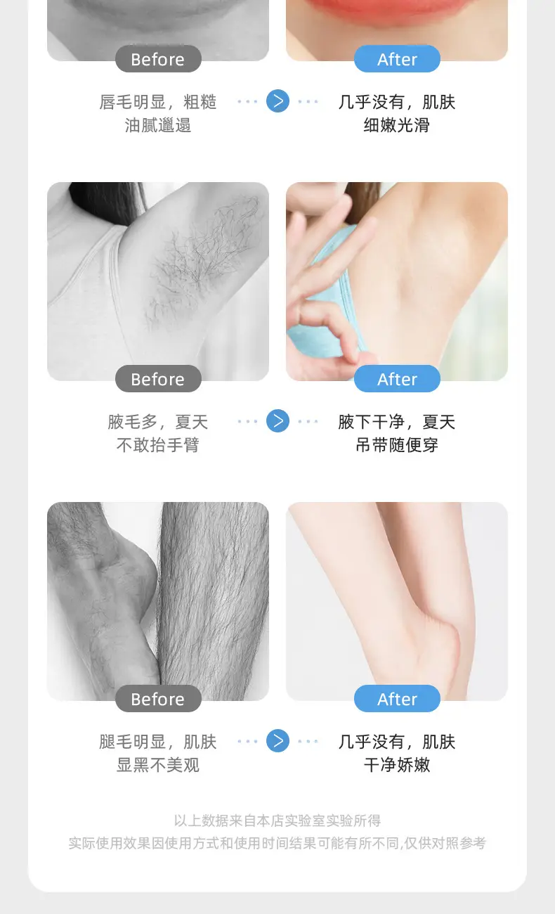 Shaving device privates female hair shaving device hair removal instrument ladies privates shaving knife pruning artifact hair plucker electric hair removal device — feature 5