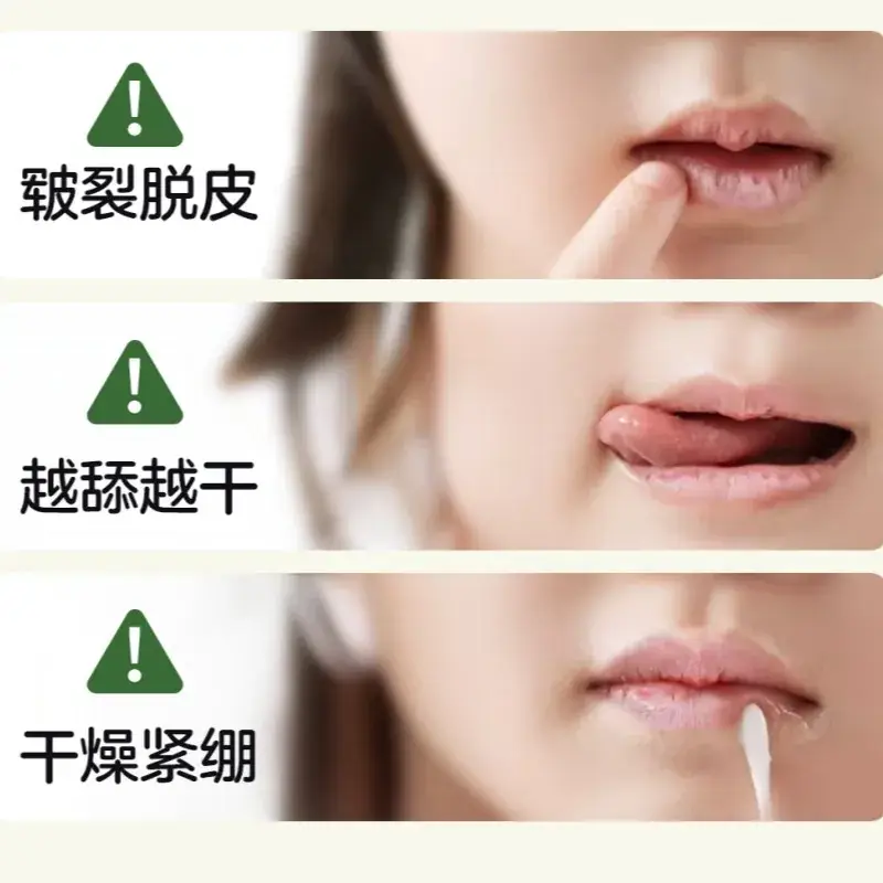 Moisturizing Lip Balm for Little Girls Autumn Winter - Image 3