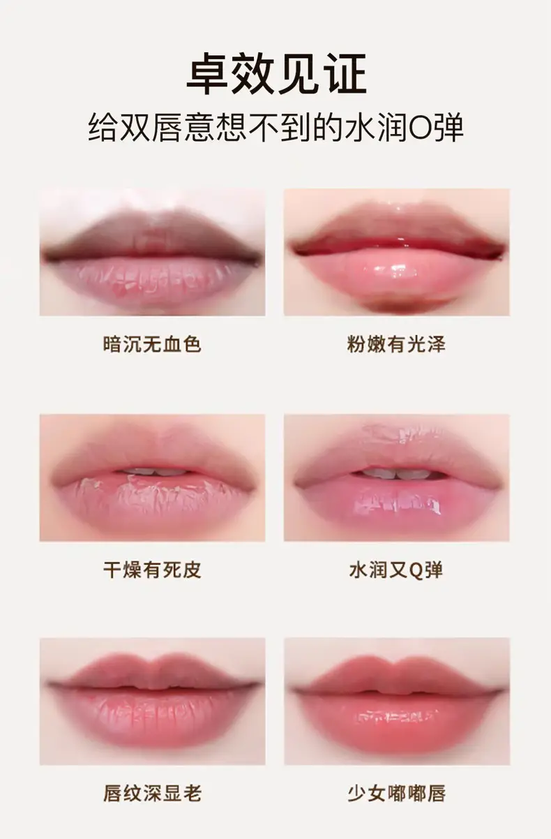 Lip Moisturizer Qingling Refined Non-Sticky Gel for Women — feature 10