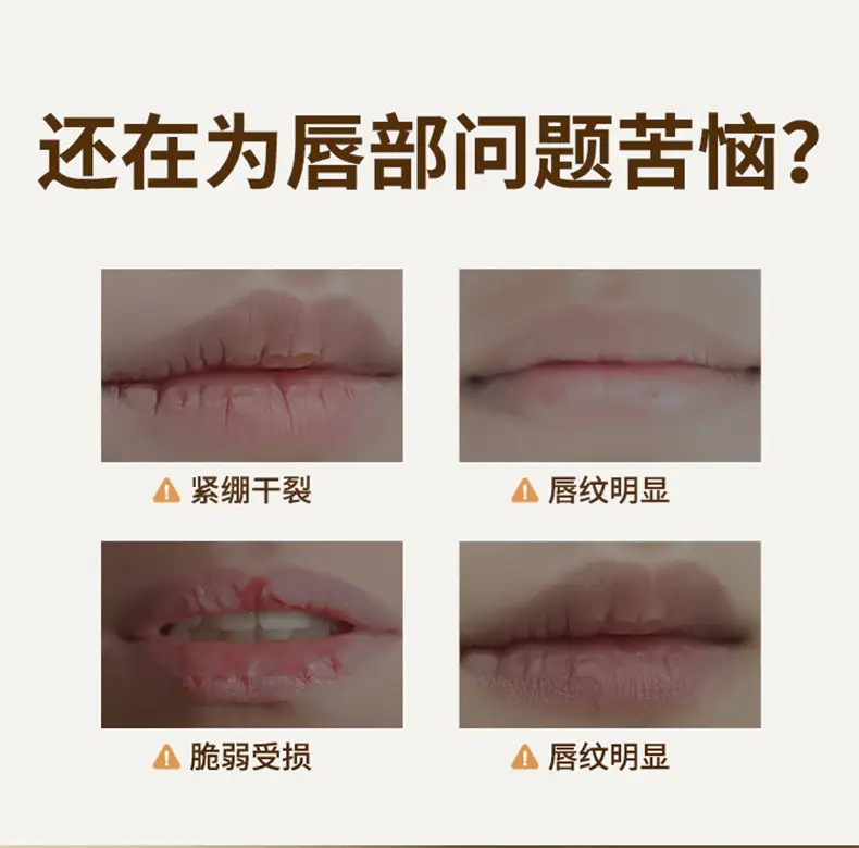 Lip Moisturizer Qingling Refined Non-Sticky Gel for Women — feature 2