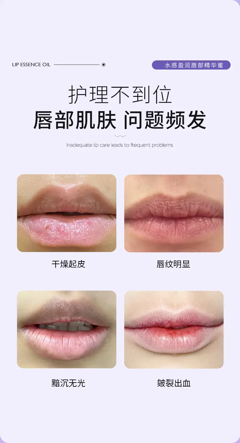 Waterproof Lip Essence Honey for Dry Lips — feature 7