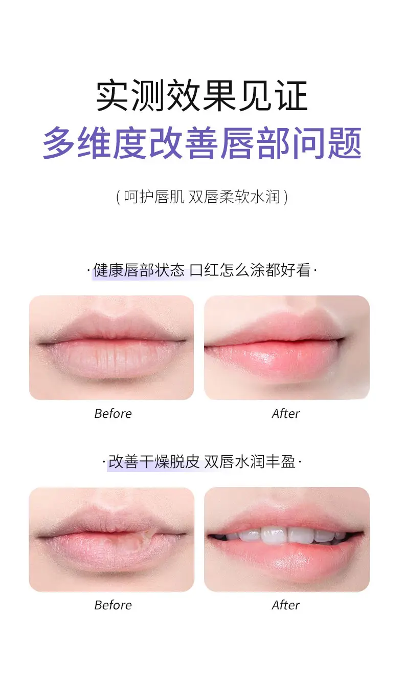 Niamah Beauty Anti-Dry Lip Essence Honey Desalination — feature 11