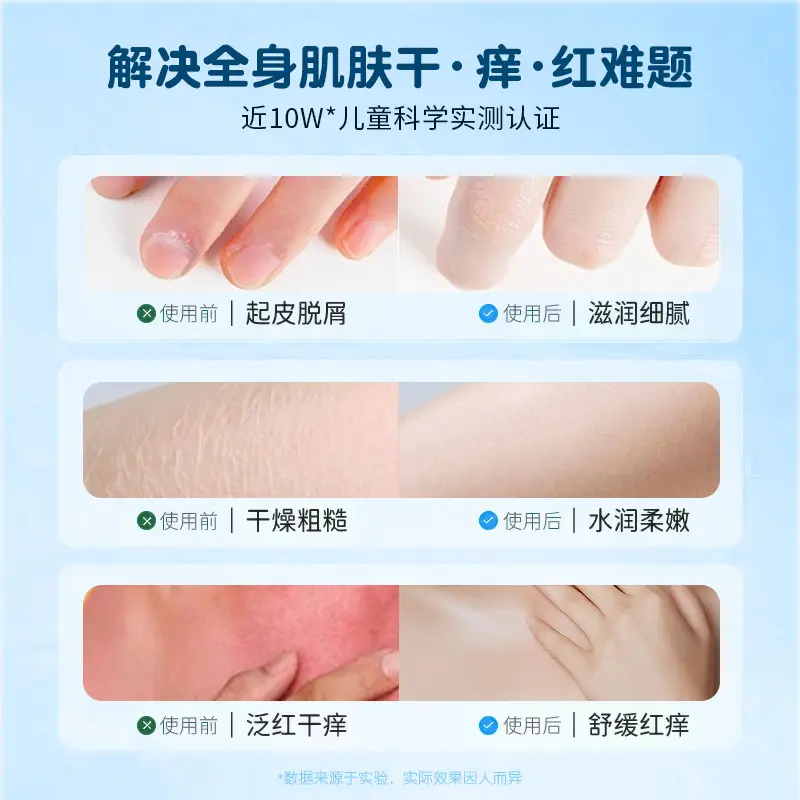 Children's Dry Skin Body Lotion Anti-Ictic Moisturizing - Image 3