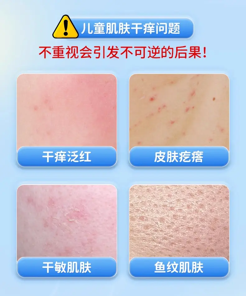 Children's Dry Skin Body Lotion Anti-Ictic Moisturizing — feature 4