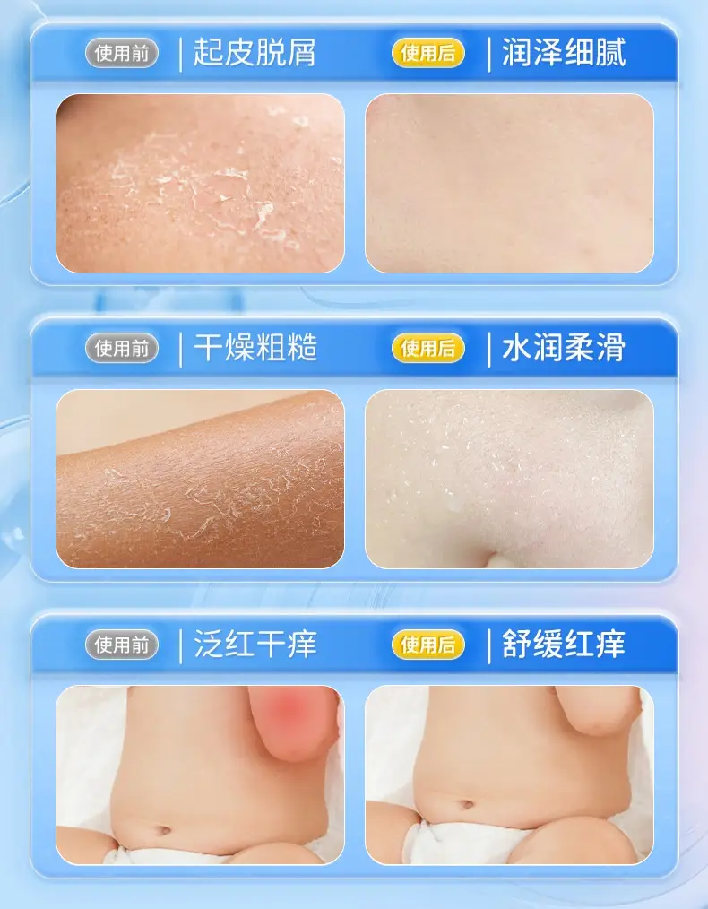 Children's Dry Skin Body Lotion Anti-Ictic Moisturizing — feature 8