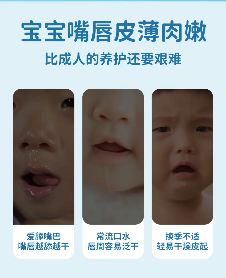 Fu Shi Ting Baby Lip Balm Moisturizing 3.5g — feature 3
