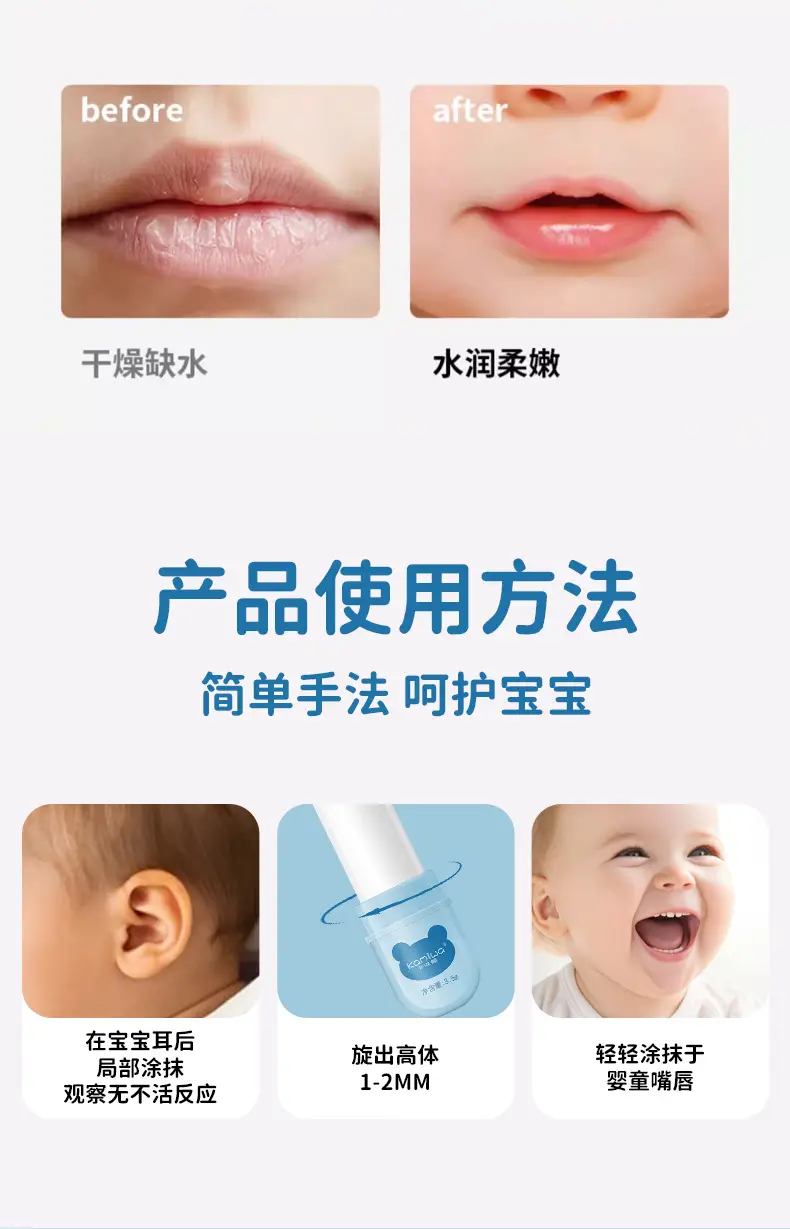 Fu Shi Ting Baby Lip Balm Moisturizing 3.5g — feature 9