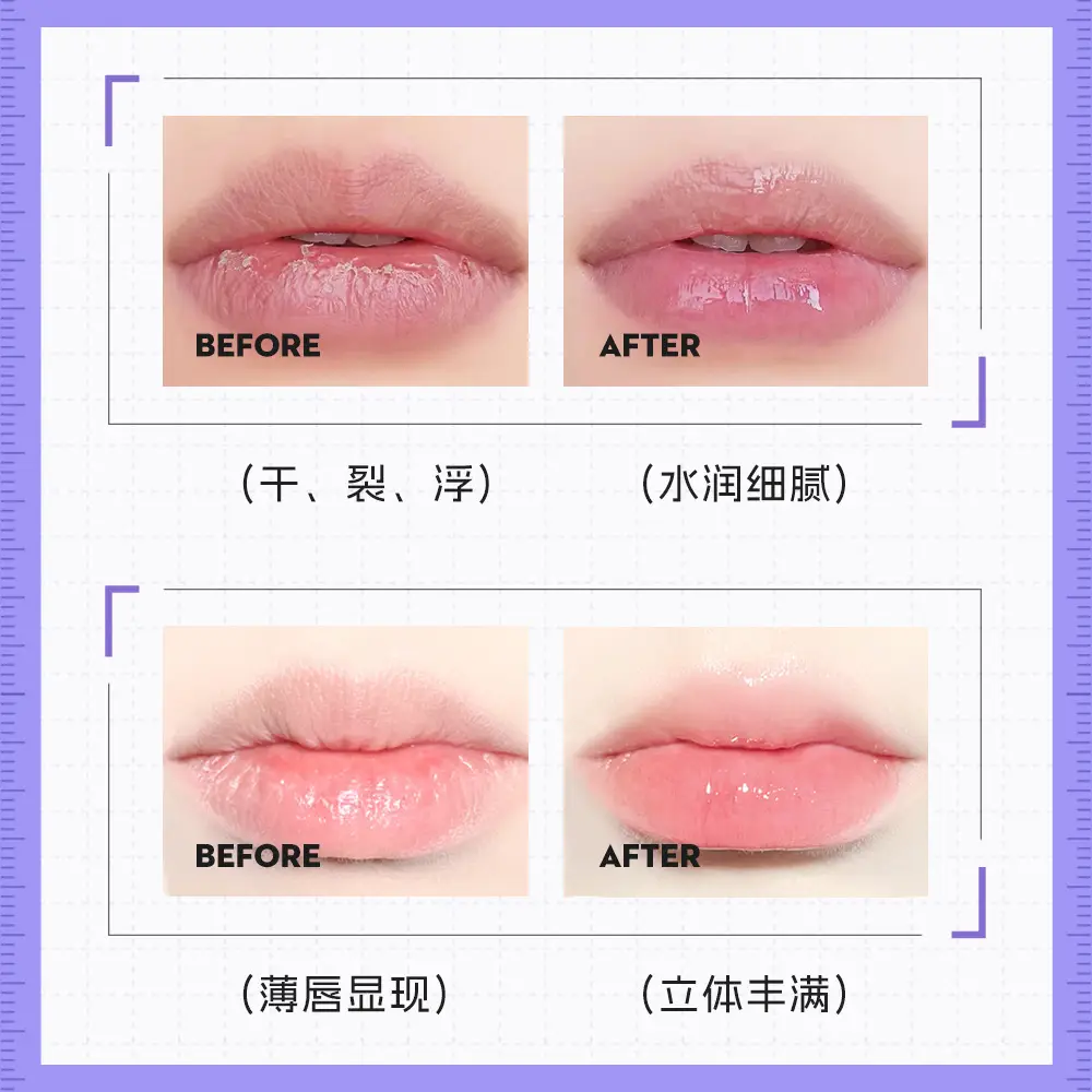 Han Po Li Moisturizing Lip Care Essence Honey - Image 7