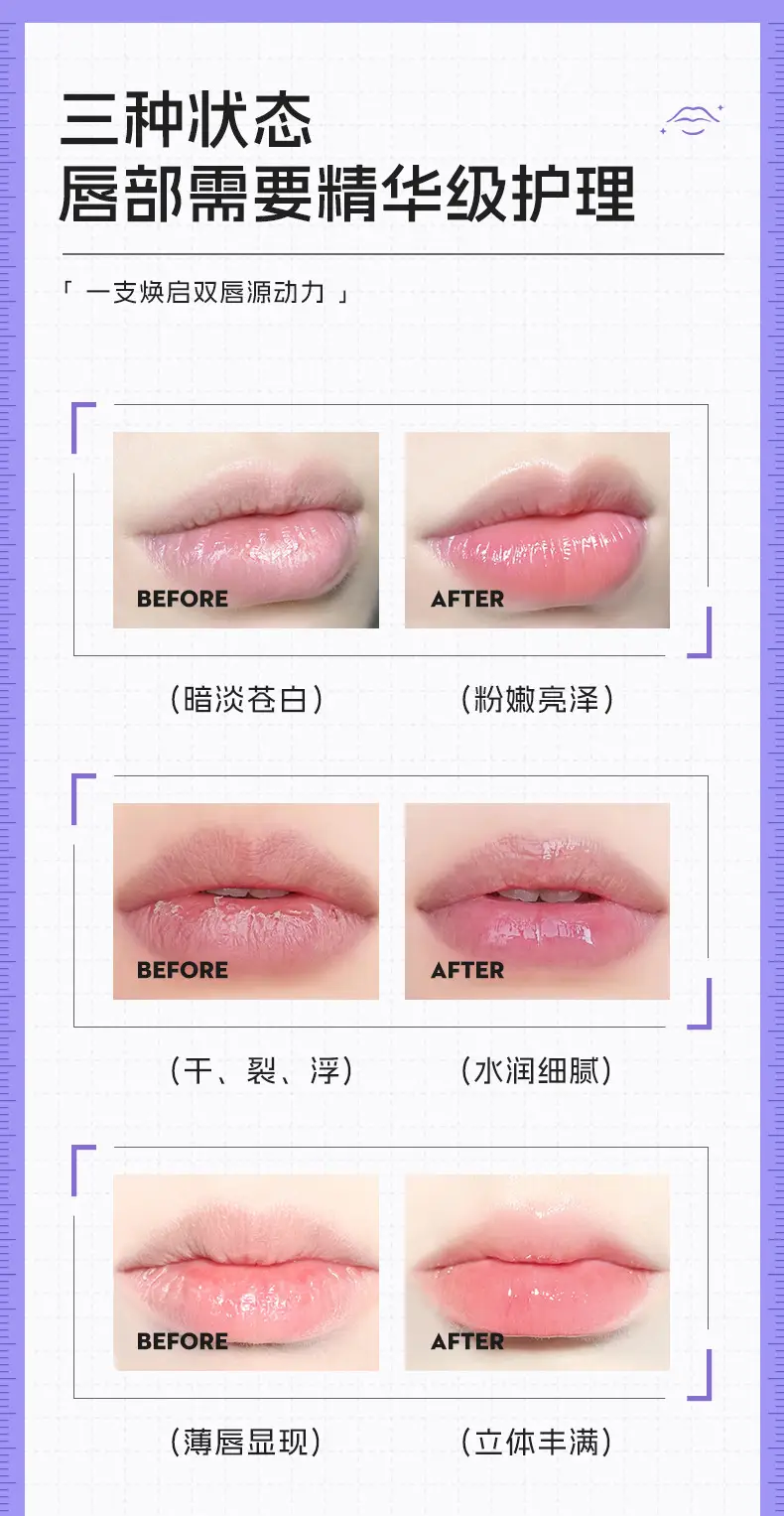 Han Po Li Moisturizing Lip Care Essence Honey — feature 4
