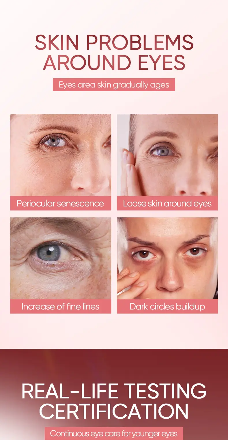 Niacotinamide Eye Cream for Dry Eyes Pink — feature 2