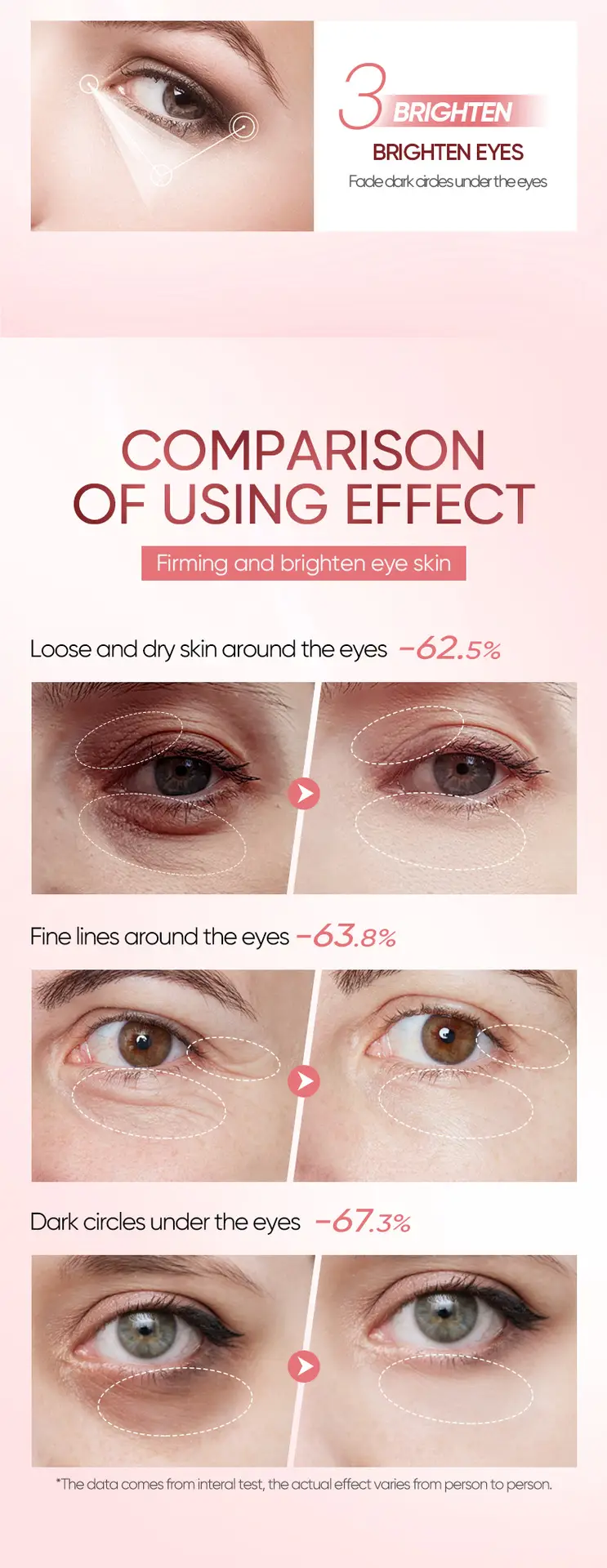 Niacotinamide Eye Cream for Dry Eyes Pink — feature 8