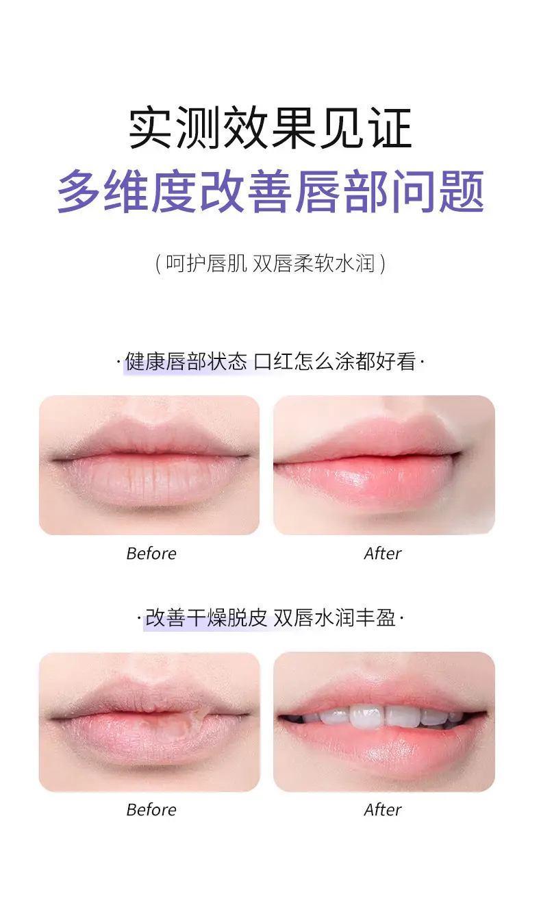 Magic Card Ruyin Moisturizing Lip Essence Honey Reducing — feature 8
