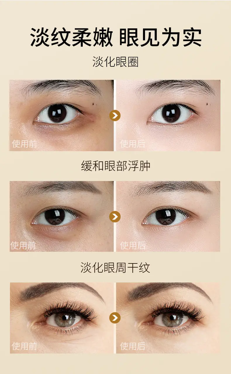 OTOU Lutein Eye Essence Oil 20ml for Dark Circles & Fine Lines — feature 8