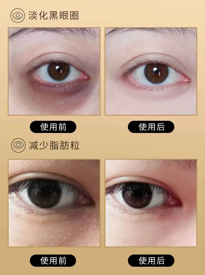 Skim Wrinkle Eye Patches for Dark Circles Lift Moisturize — feature 4