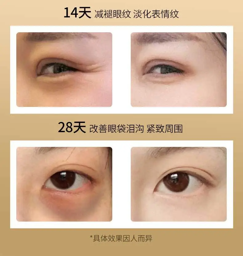 Skim Wrinkle Eye Patches for Dark Circles Lift Moisturize — feature 6