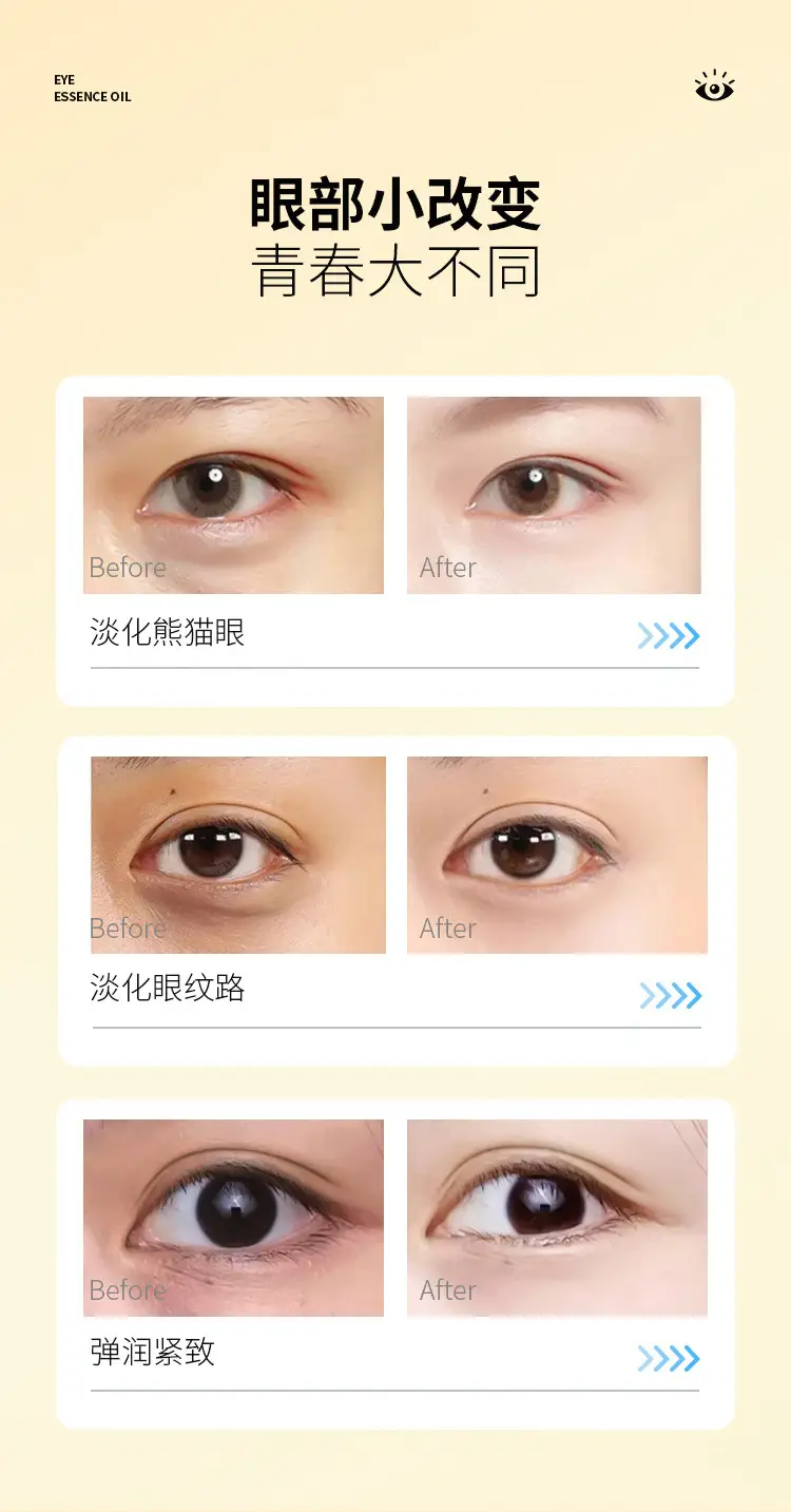 Dr. Lutein Eye Oil for Dark Circles & Wrinkles — feature 14