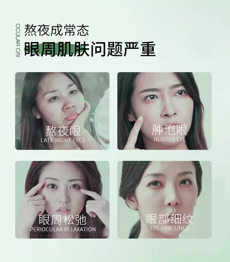 Su Xiu Chen Polypeptide Eye Cream Dark Circles Fades — feature 2