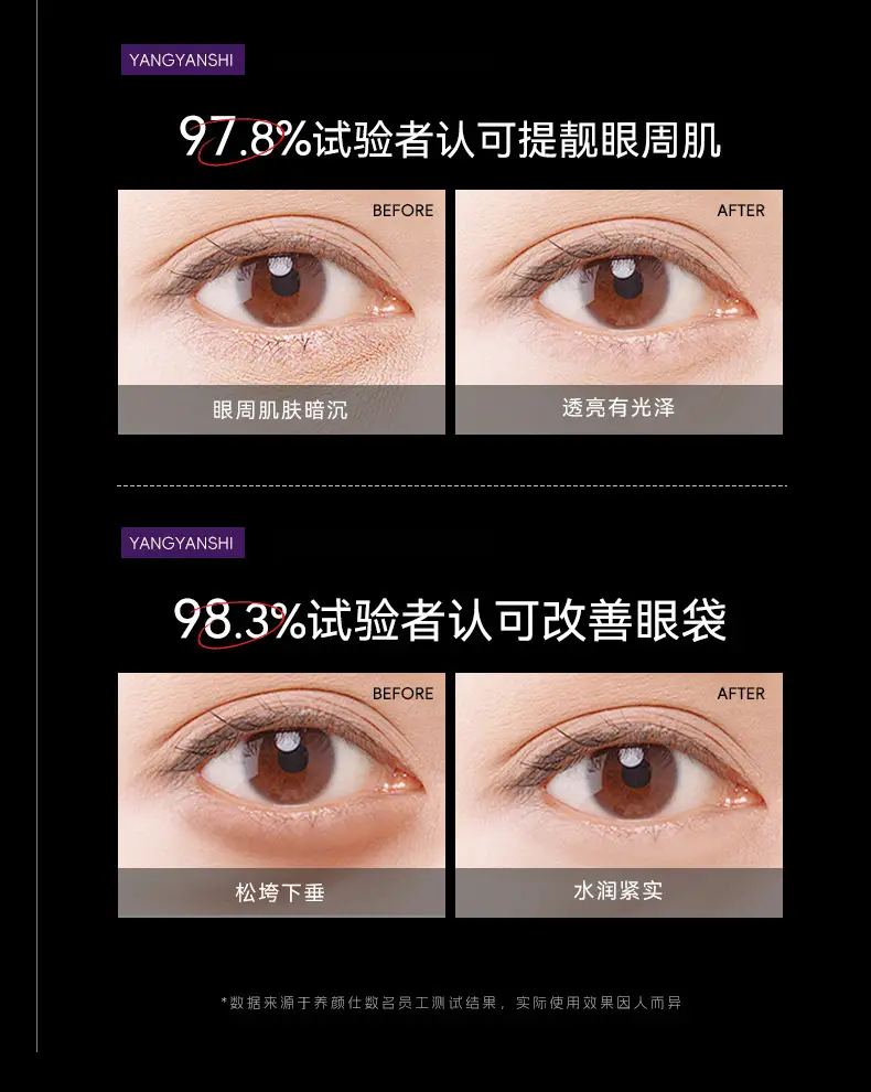 Yangyan Shi Fu Anti-Wrinkle Eye Essence Oil — feature 13