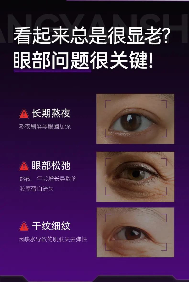 Yangyan Shi Fu Anti-Wrinkle Eye Essence Oil — feature 3