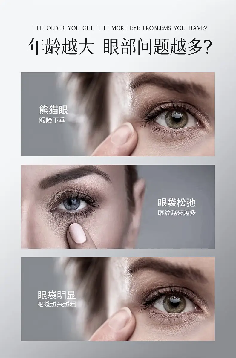 Yaping Essential Eye Cream for Dark Circles & Fat Granules — feature 2