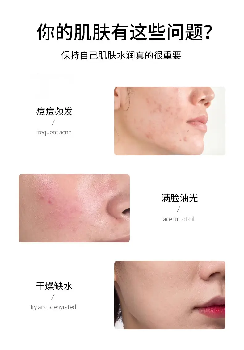 Zhenxian Aloe Vera Gel Toner 70g Moisturizing Hydrating — feature 3
