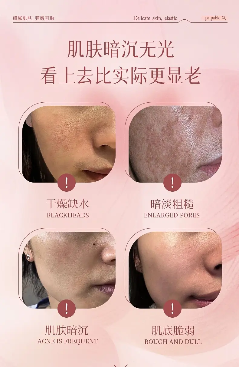 Mengsi Love Camellia Hydrating Moisturizer Emulsion — feature 9