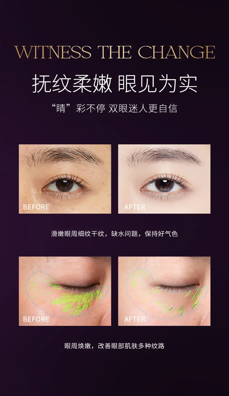 Anti-Wrinkle Eye Essence Oil for Soft & Light Eyes — feature 10