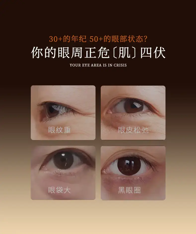 NICD Whitening Anti-Aging Eye Cream for Dark Circles & Wrinkles — feature 2