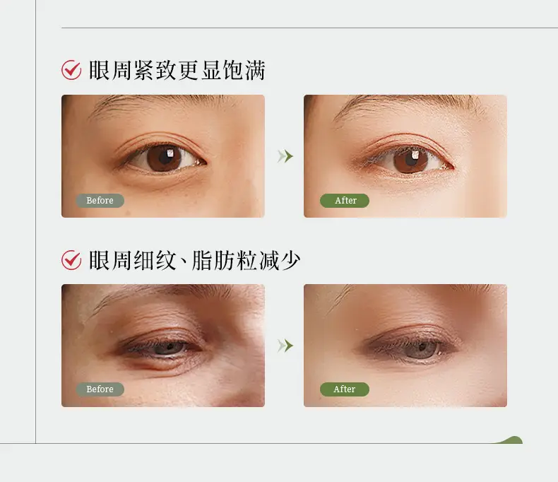 Dr. Na Lan Eye Cream Muscle Clearing Anti-Wrinkle Moisturizing — feature 7