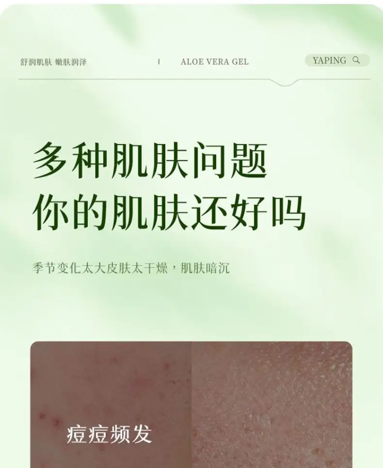 Aloe Vera Moisturizer Gel for Dry Skin 100% — feature 3