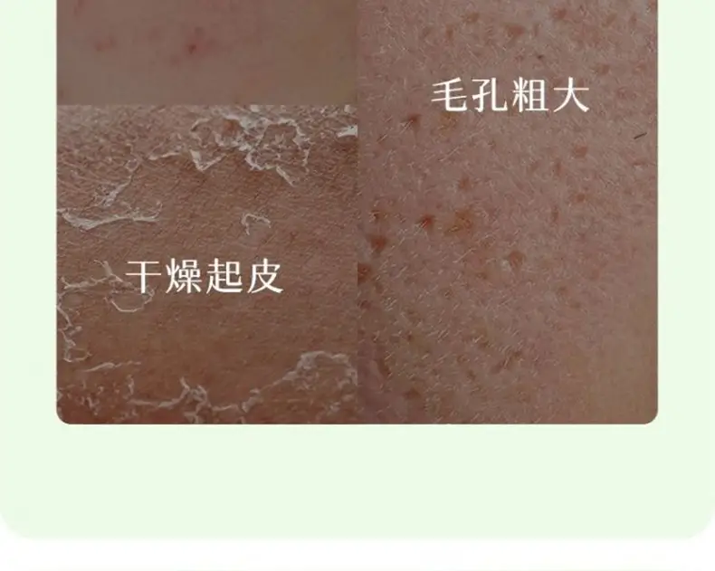 Aloe Vera Moisturizer Gel for Dry Skin 100% — feature 4