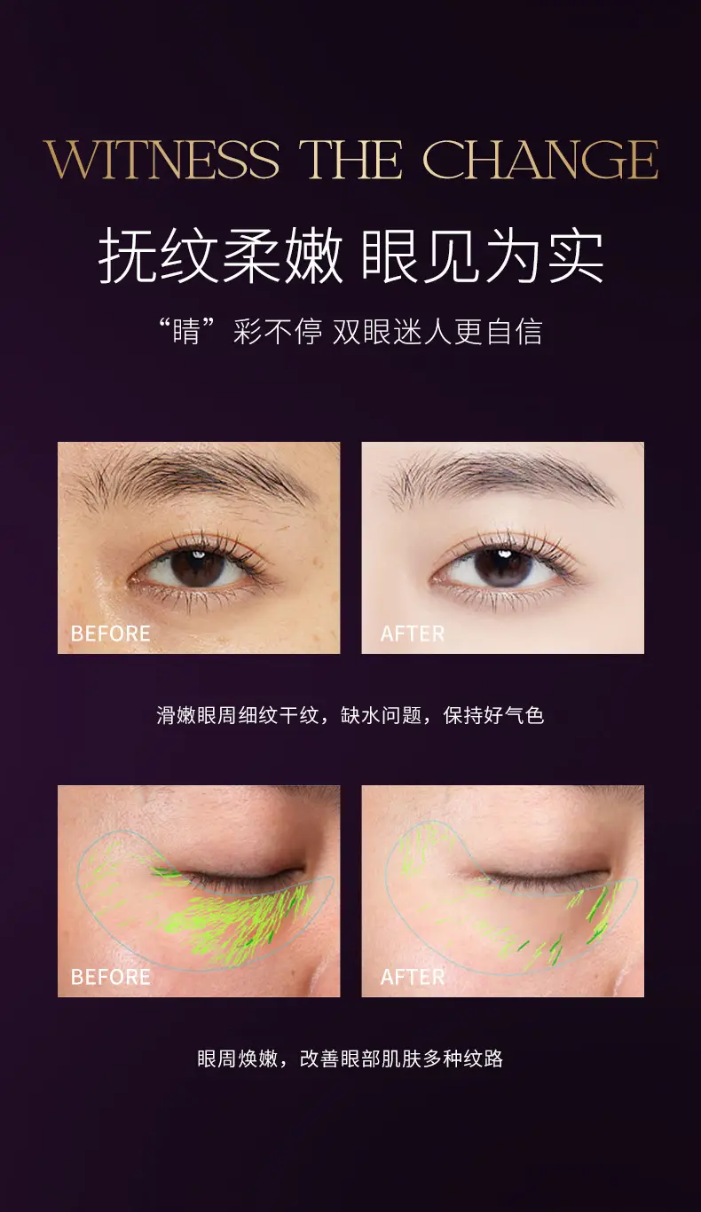 Haizier Anti-Wrinkle Eye Essence Oil 3ml — feature 12