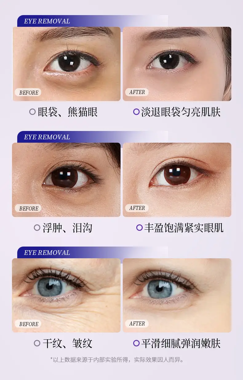 Tilting Eye Cream for Fine Lines & Wrinkles — feature 13