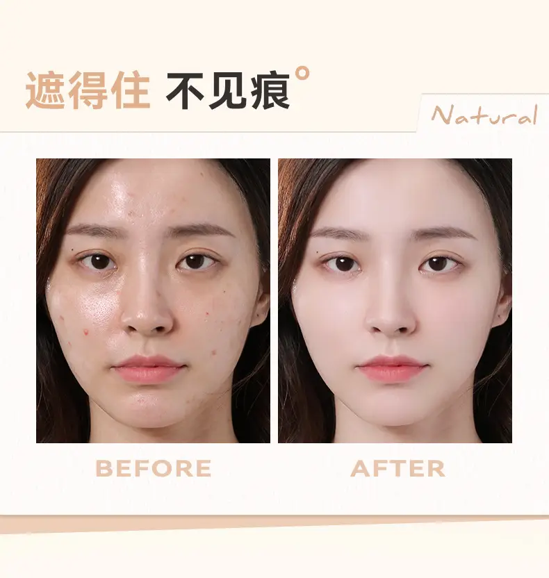 Three-Color Concealer for Acne & Dark Circles — feature 9