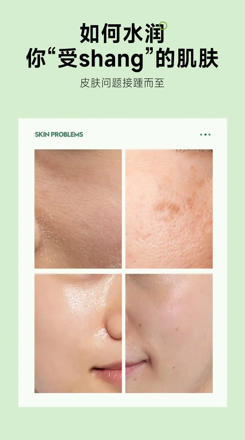 Dream Baiyan Aloe Vera Moisturizer 6H Freshness — feature 4