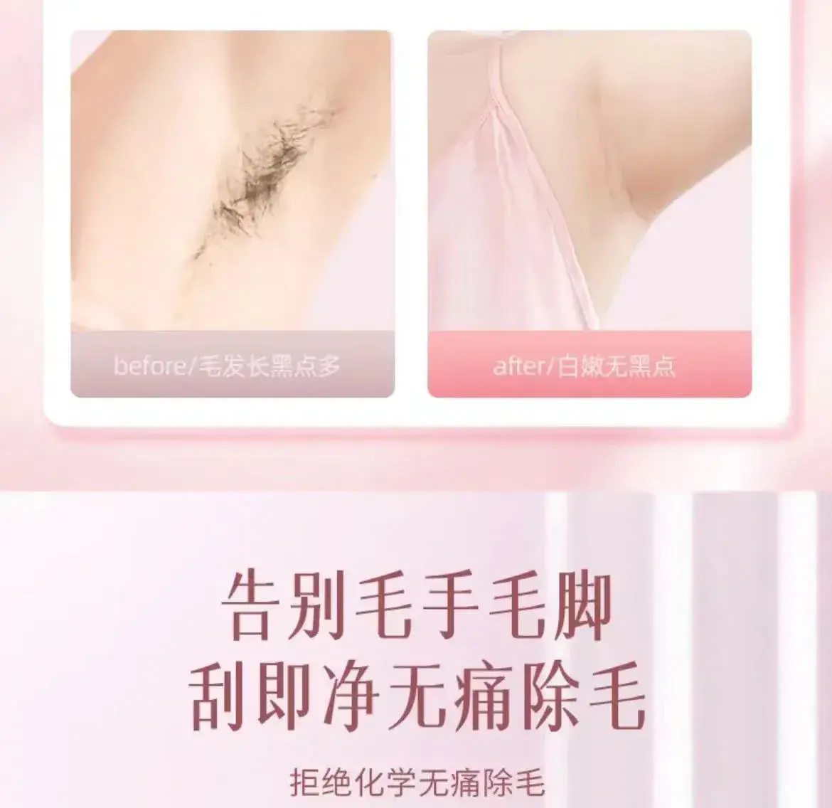 Pink 5-Blade Women's Hair Removal Knife for Armpit & Leg — feature 3