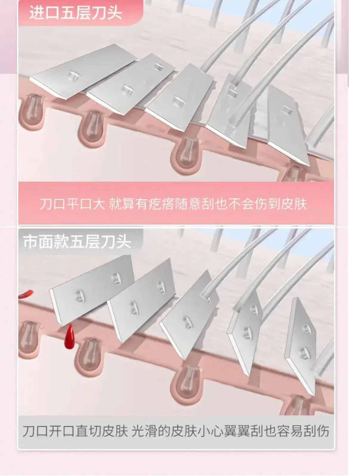 Pink 5-Blade Women's Hair Removal Knife for Armpit & Leg — feature 5