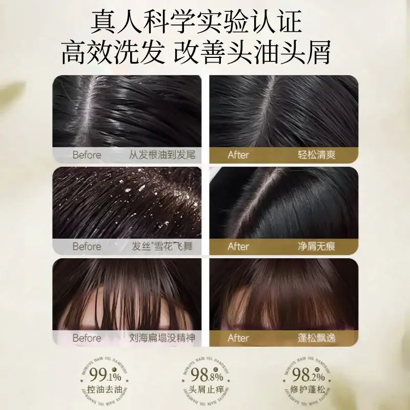 Beauty Road White Truffle Shampoo, Shower Gel, Conditioner, Oil Control, Fluffy, Anti-Dandruff, Improves Frizz Shampoo Set
