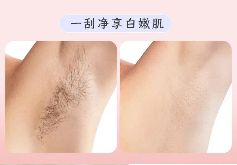 Women's Shaving Razor for Underarm Hair Removal, Hair Trimmer for Female Intimate Areas, Portable Hair Removal Tool — feature 20
