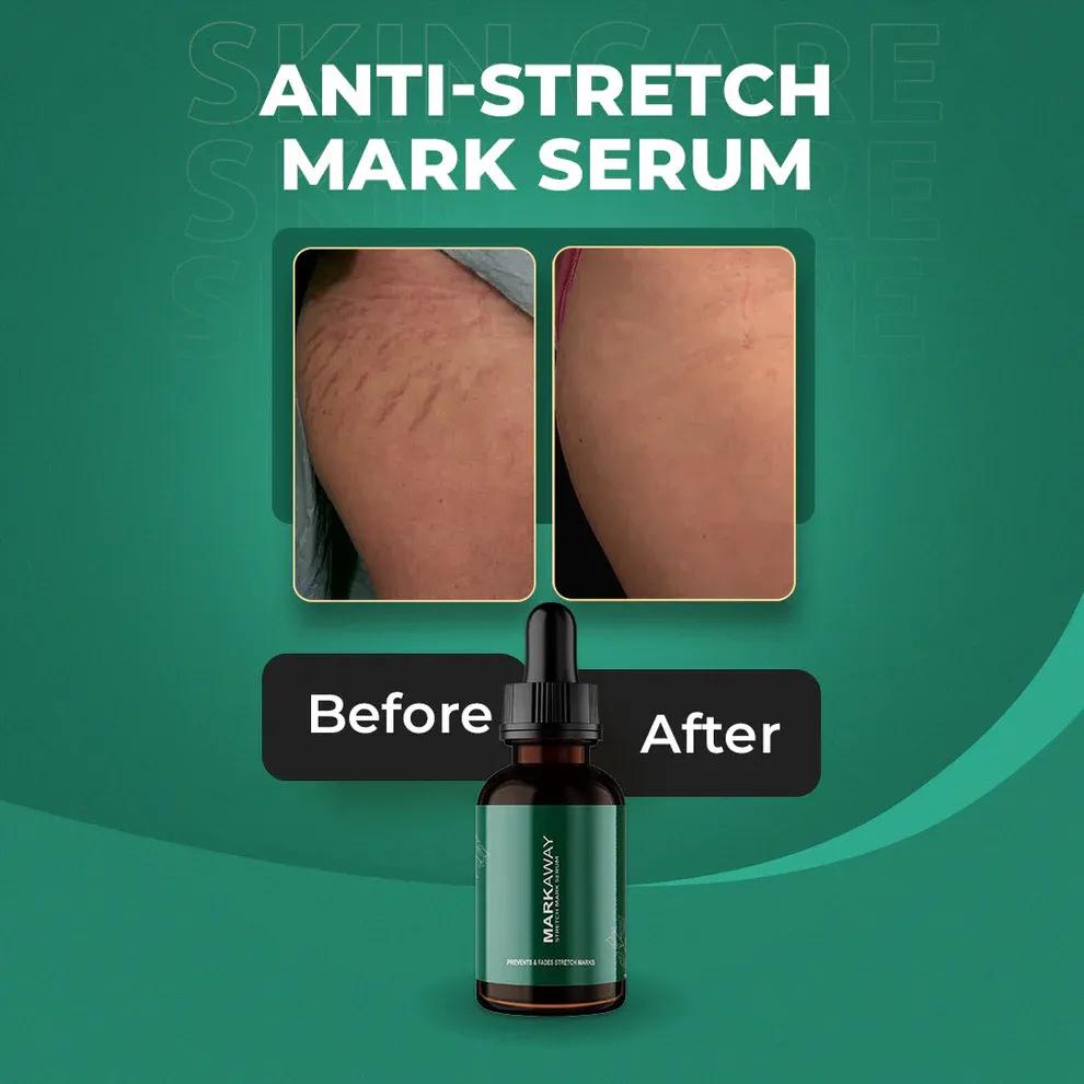 Anti-Aging Stretch Mark Serum for Pregnant Women