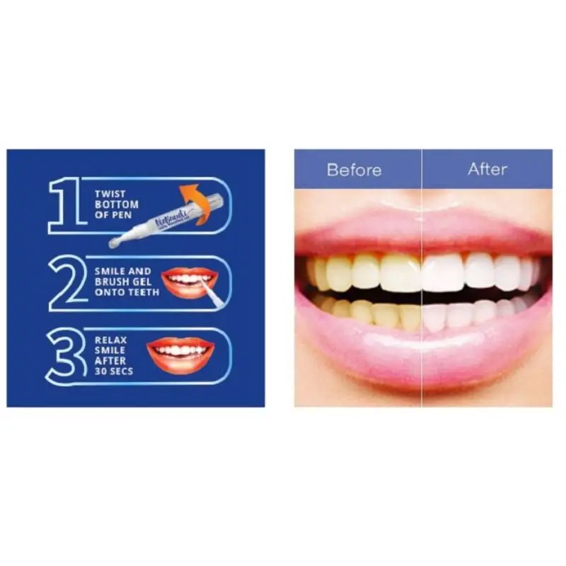 Dazzling White Instant Teeth Whitening Pen