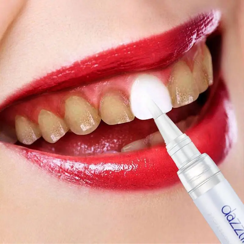 Dazzling White Instant Teeth Whitening Pen