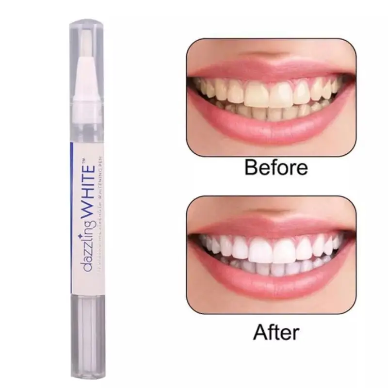 Dazzling White Instant Teeth Whitening Pen
