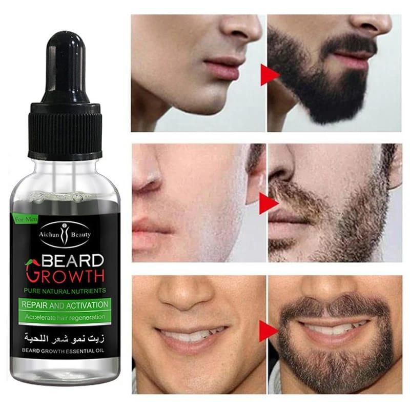30ml Beard Oil for Growth & Dandruff Control