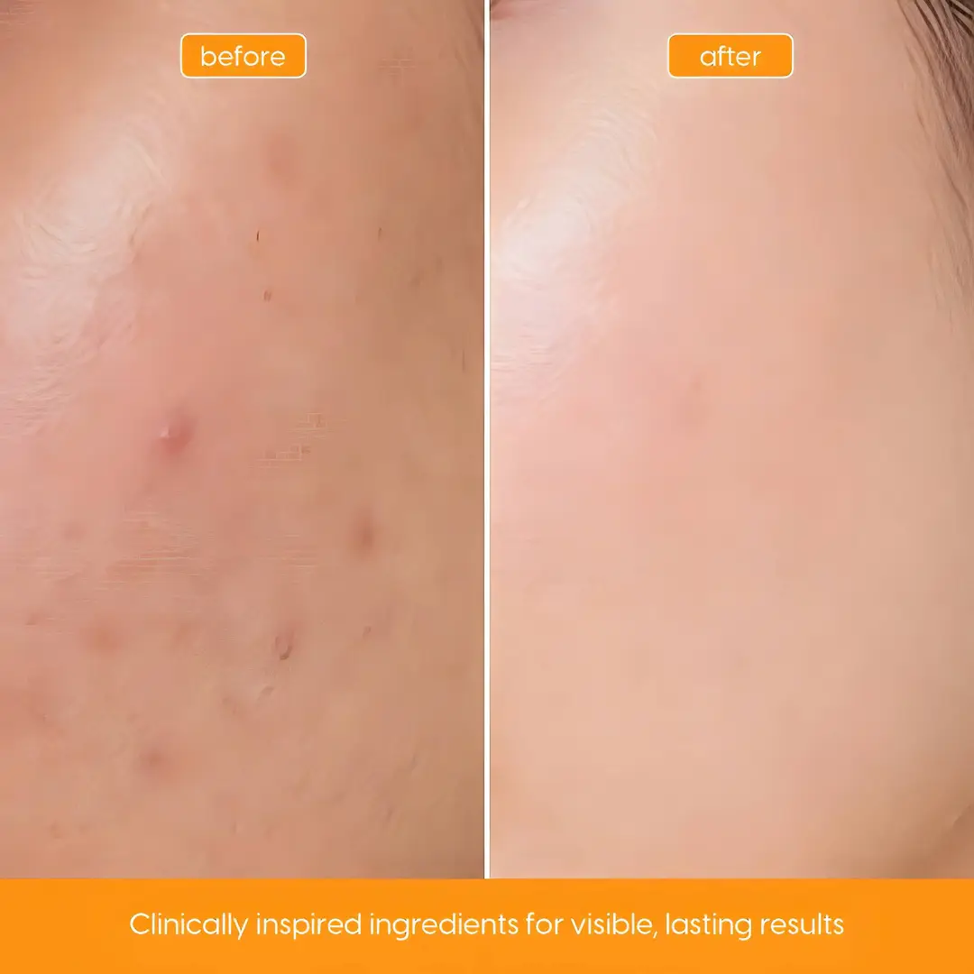 Vitamin C Serum for Brightening, Dark Spots & Uneven Tone